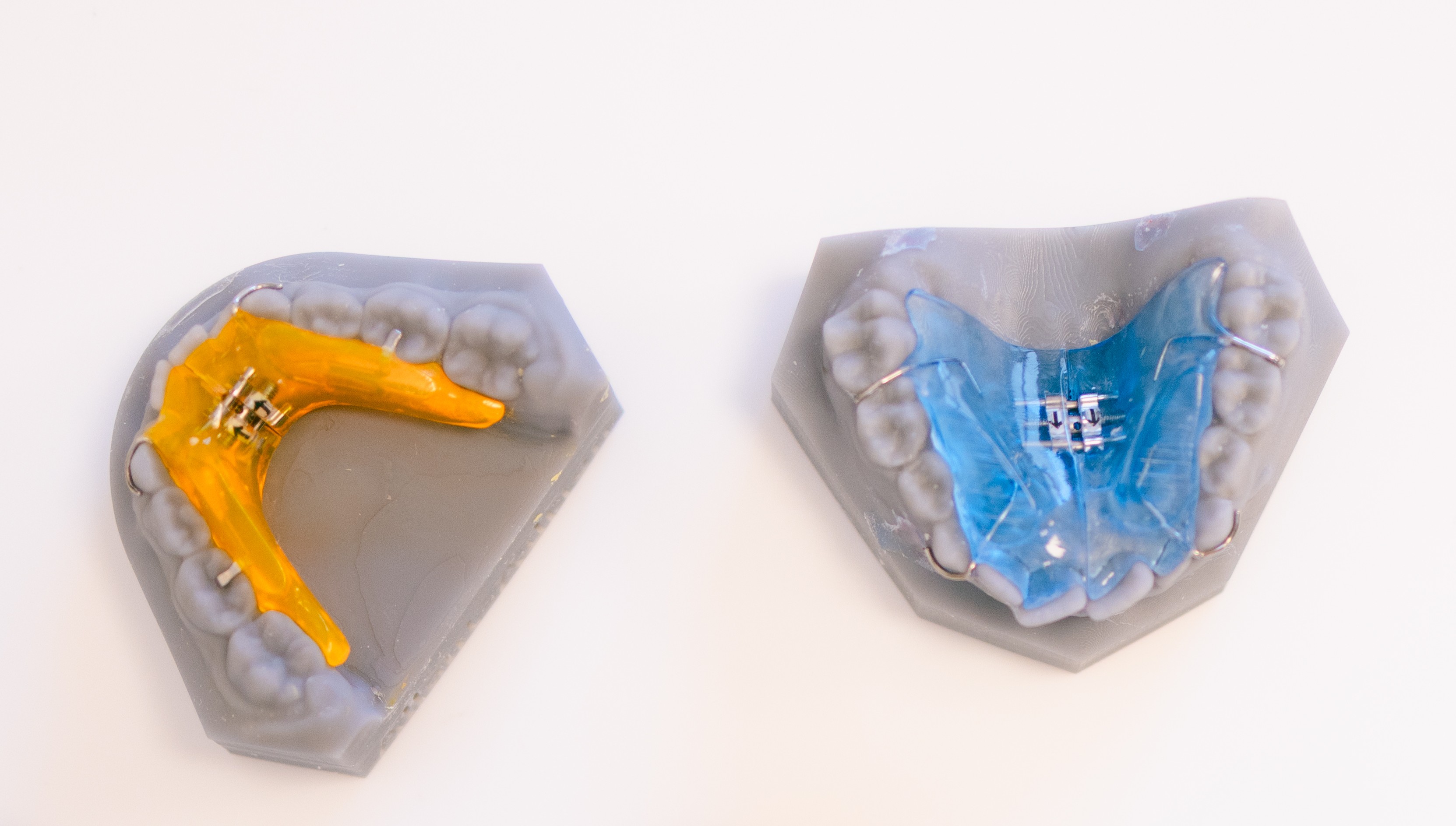 Traitement orthodontico chirurgical